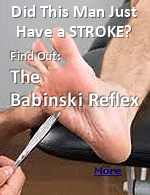 The Babinski Reflex is a hallmark neurological test that plays a pivotal role in assessing the integrity of the central nervous system. Whether you�re a medical student preparing for the NCLEX or MCAT, a nursing student, or in any health-allied field, mastering this concept is crucial. This post will simplify the Babinski Reflex and help you understand its clinical relevance.